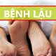 PK ĐA KHOA Y HỌC QUỐC TẾ – CHỮA BỆNH LẬU KHỎI SAU 1 LIỆU TRÌNH