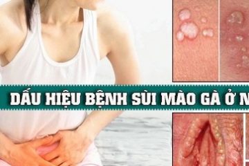 DẤU HIỆU SÙI MÀO GÀ Ở NỮ, NGUYÊN NHÂN VÀ CÁCH HỖ TRỢ ĐIỀU TRỊ MỚI