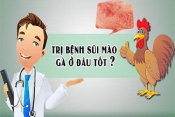 Bị Bệnh Sùi Mào Gà Và Cách Hỗ Trợ Điều Trị