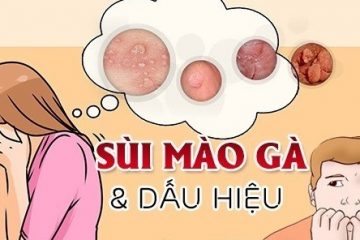 Bệnh Sùi Mào Gà Ở Dương Vật