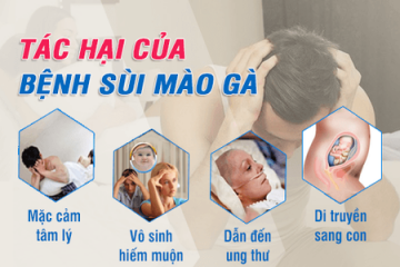 Dấu Hiệu Sùi Mào Gà Ở Nam Giới Và Phương Pháp Chữa Sùi Mào Gà Nam Không Bị Lại