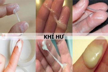 Bệnh Lậu Ở Nữ Giới Và Địa Chỉ Chữa Bệnh Lậu